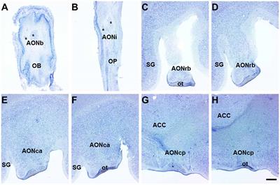 Differential Effects of Parkinson’s Disease on Interneuron Subtypes within the Human Anterior Olfactory Nucleus